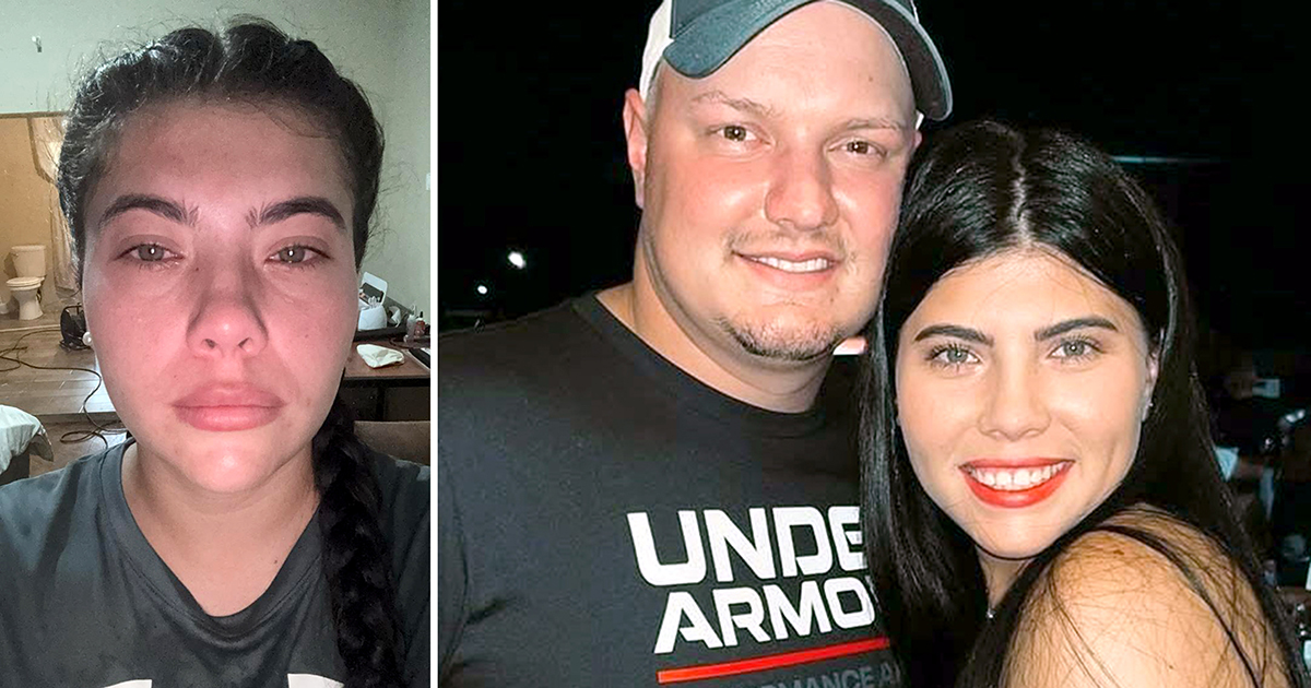 Benoude oomblikke vir jong vrou nadat kobra haar in die oë spoeg